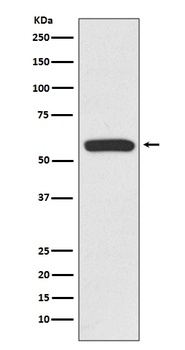 IRF6 Rabbit Monoclonal Antibody