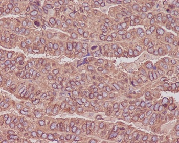 beta III Tubulin TUBB3 Rabbit Monoclonal Antibody