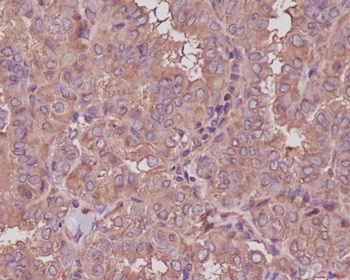 beta III Tubulin TUBB3 Rabbit Monoclonal Antibody