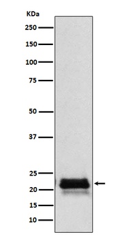 FSH beta Rabbit Monoclonal Antibody