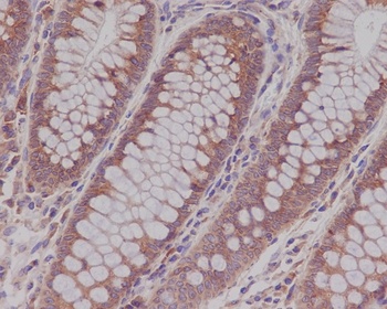 Rab5 RAB5A Rabbit Monoclonal Antibody