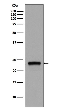 Rab5 RAB5A Rabbit Monoclonal Antibody