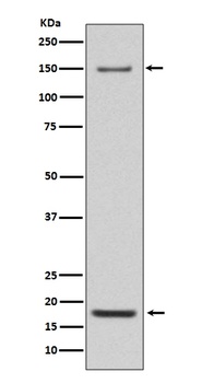 Integrin alpha 5 ITGA5 Rabbit Monoclonal Antibody