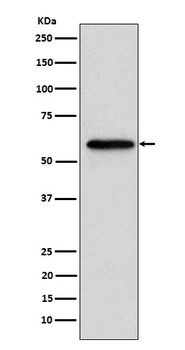 Retinoic Acid Receptor beta RARB Rabbit Monoclonal Antibody