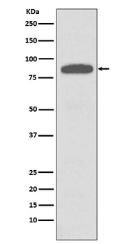 IKK alpha+beta CHUK Rabbit Monoclonal Antibody