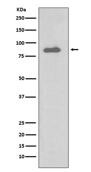 IKK alpha CHUK Rabbit Monoclonal Antibody