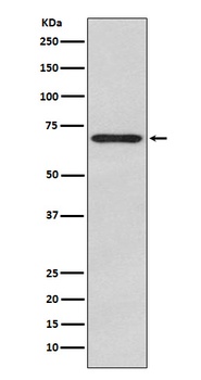 Glypican 3 Rabbit Monoclonal Antibody
