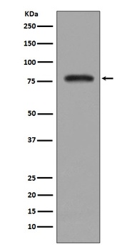 PKC beta 2 PRKCB Rabbit Monoclonal Antibody