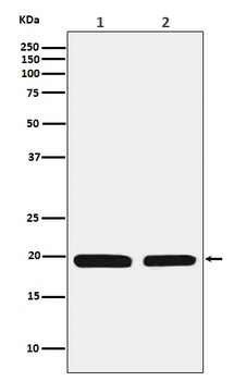 Ferritin Light Chain FTL Rabbit Monoclonal Antibody