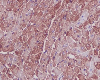 Actin ACTA1 Rabbit Monoclonal Antibody