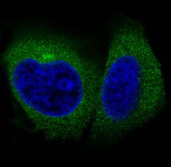 Actin ACTA1 Rabbit Monoclonal Antibody