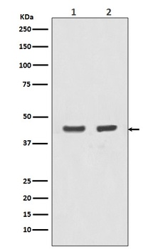 Actin (Alpha-Actin) ACTA1 Rabbit Monoclonal Antibody