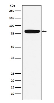 Factor XIIIa F13A1 Rabbit Monoclonal Antibody