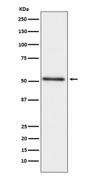Prostatic Acid Phosphatase ACPP Rabbit Monoclonal Antibody