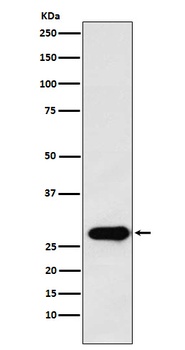 Securin Rabbit Monoclonal Antibody