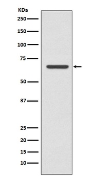 CPT2 Rabbit Monoclonal Antibody