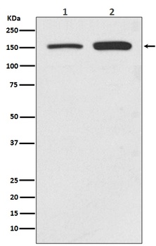 SMC1 SMC1A Rabbit Monoclonal Antibody