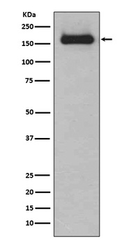 HDAC9 Rabbit Monoclonal Antibody