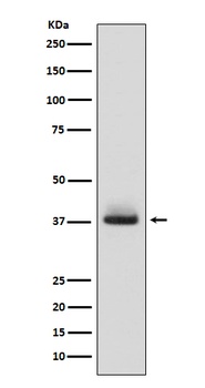 Glycophorin A GYPA Rabbit Monoclonal Antibody