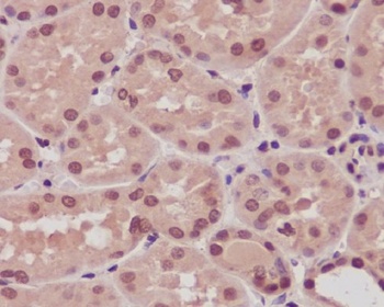 ARRB1/Beta Arrestin 1 Rabbit Monoclonal Antibody
