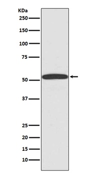 ARRB1/Beta Arrestin 1 Rabbit Monoclonal Antibody