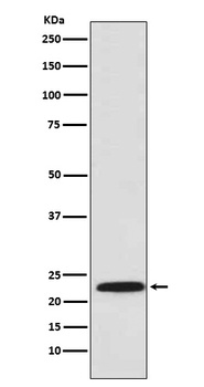 PSMB8/LMP7 Rabbit Monoclonal Antibody