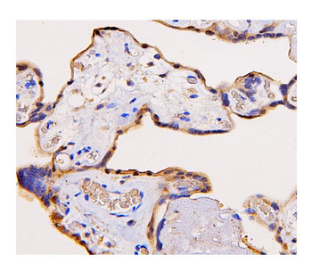 ADK Mouse Monoclonal Antibody