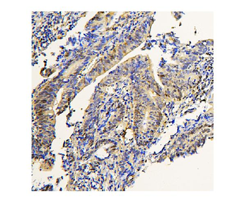 ADK Mouse Monoclonal Antibody