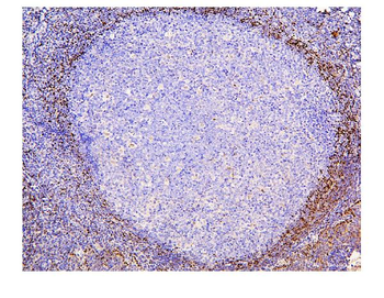 ADK Mouse Monoclonal Antibody