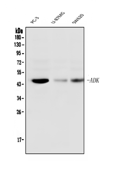 ADK Mouse Monoclonal Antibody
