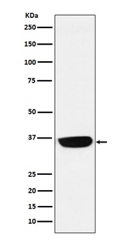 PHOX2B Rabbit Monoclonal Antibody