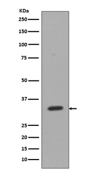 CD8 CD8A Rabbit Monoclonal Antibody