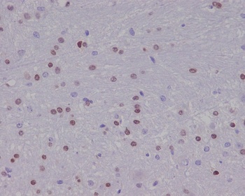 Olig2 Rabbit Monoclonal Antibody
