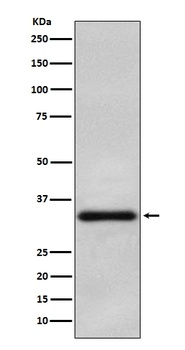 Olig2 Rabbit Monoclonal Antibody