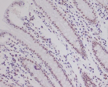 HIF-1 beta ARNT/HIF Rabbit Monoclonal Antibody