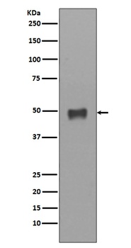 Cytokeratin 17 Rabbit Monoclonal Antibody