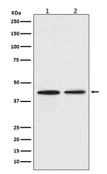 CCR9 Rabbit Monoclonal Antibody