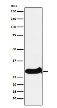 IGFBP7 Rabbit Monoclonal Antibody