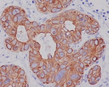 Cytokeratin 7 KRT7 Rabbit Monoclonal Antibody