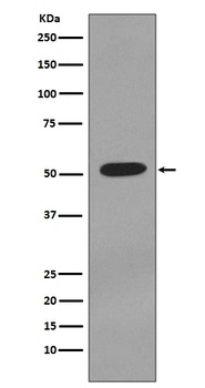 Cytokeratin 7 KRT7 Rabbit Monoclonal Antibody
