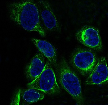 Cytokeratin 7 KRT7 Rabbit Monoclonal Antibody
