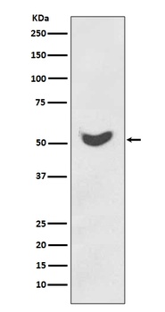 Cytokeratin 7 KRT7 Rabbit Monoclonal Antibody