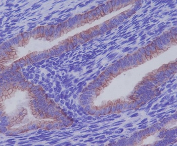 Cytokeratin 7 KRT7 Rabbit Monoclonal Antibody