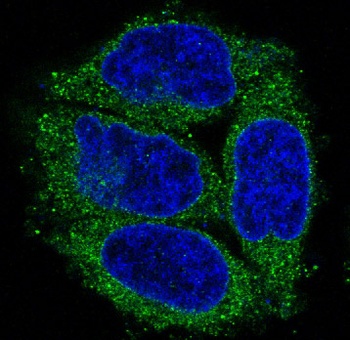 Cytokeratin 7 KRT7 Rabbit Monoclonal Antibody