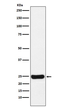 Cathepsin S CTSS Rabbit Monoclonal Antibody