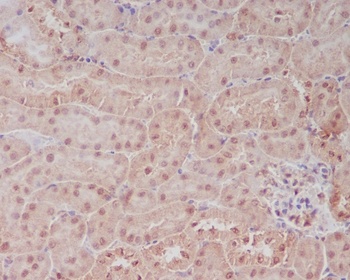 PELP1 Rabbit Monoclonal Antibody