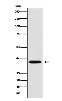 MBD3 Rabbit Monoclonal Antibody