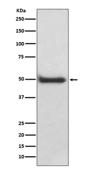 CaMKII delta CAMK2D Rabbit Monoclonal Antibody