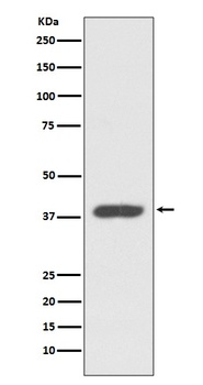 CXCR7 ACKR3 Rabbit Monoclonal Antibody
