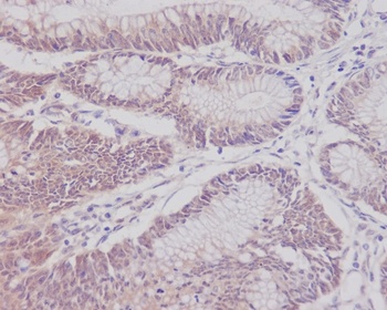 CD3 epsilon Rabbit Monoclonal Antibody